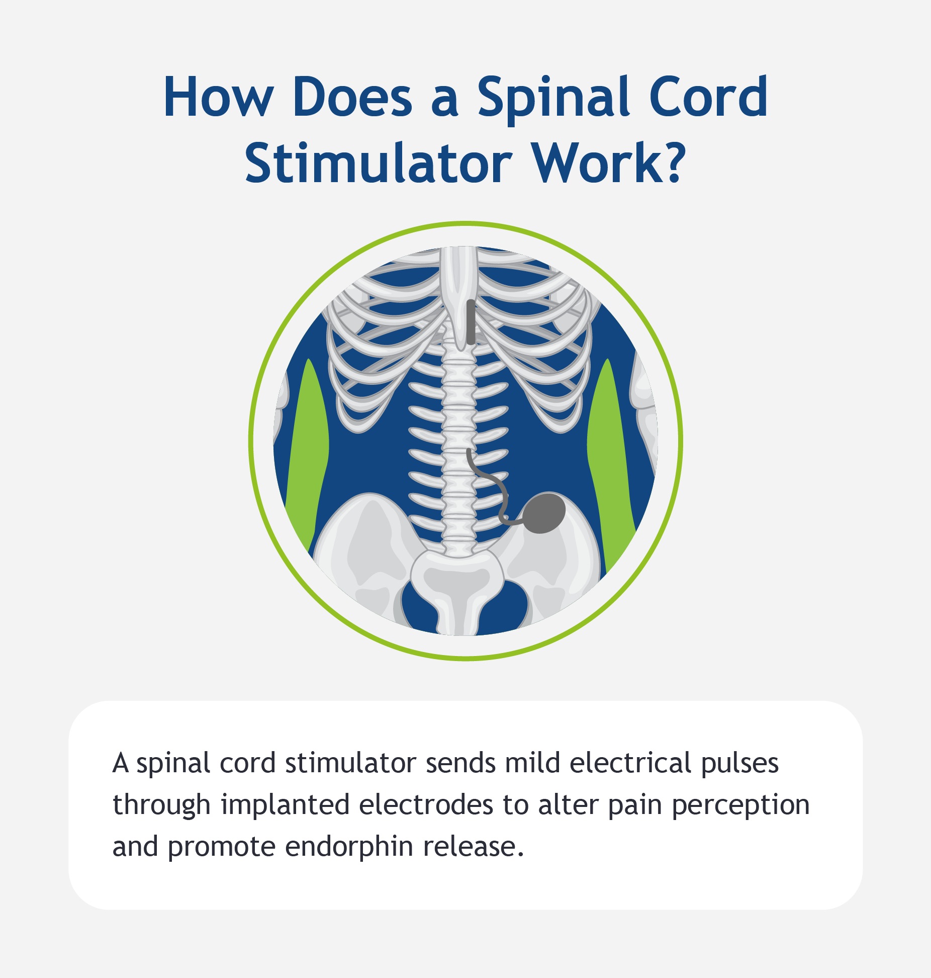 An graphic describing how a spinal cord simulator works.