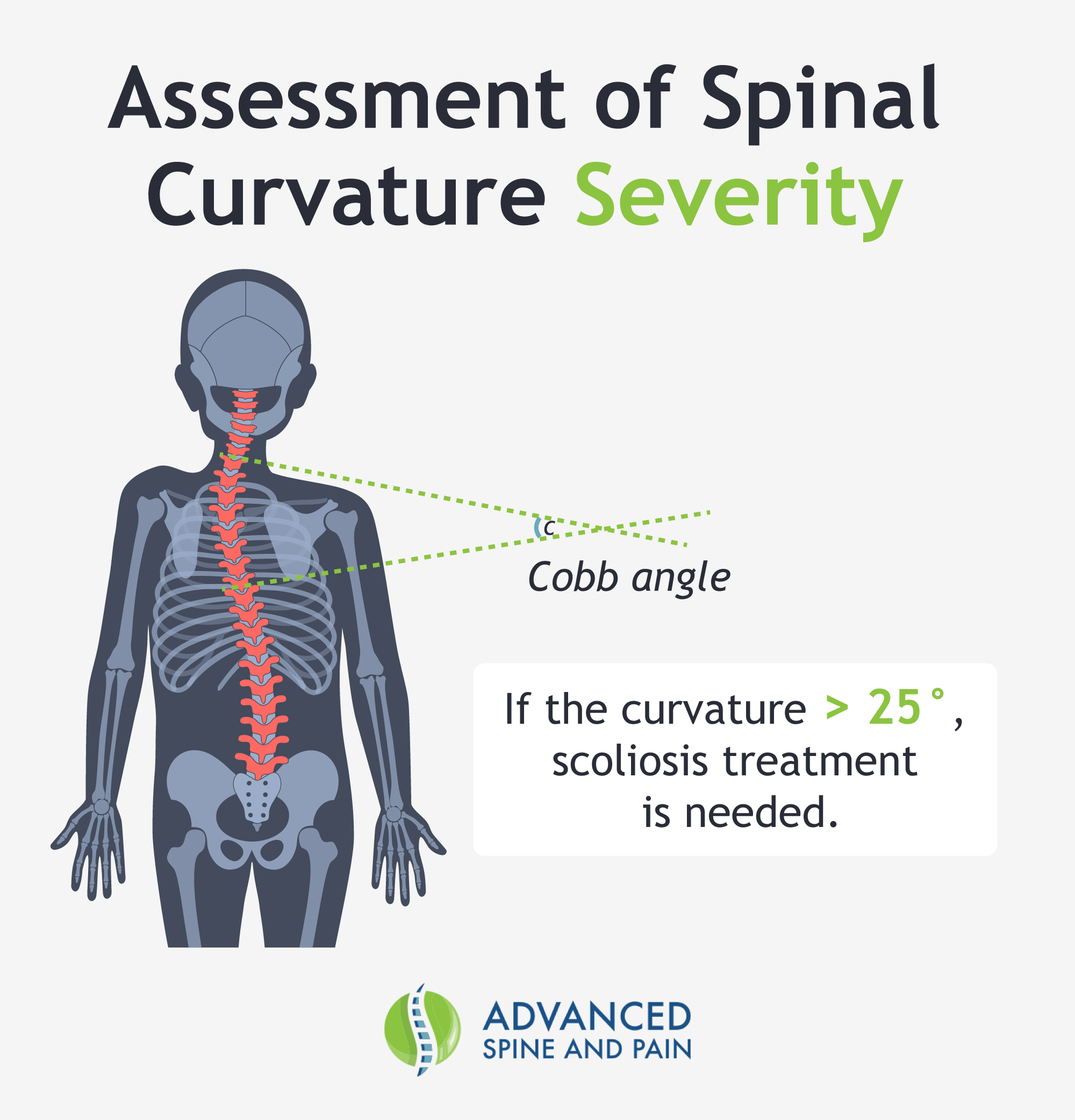 A graphic describing how spinal curvature severity is assessed.