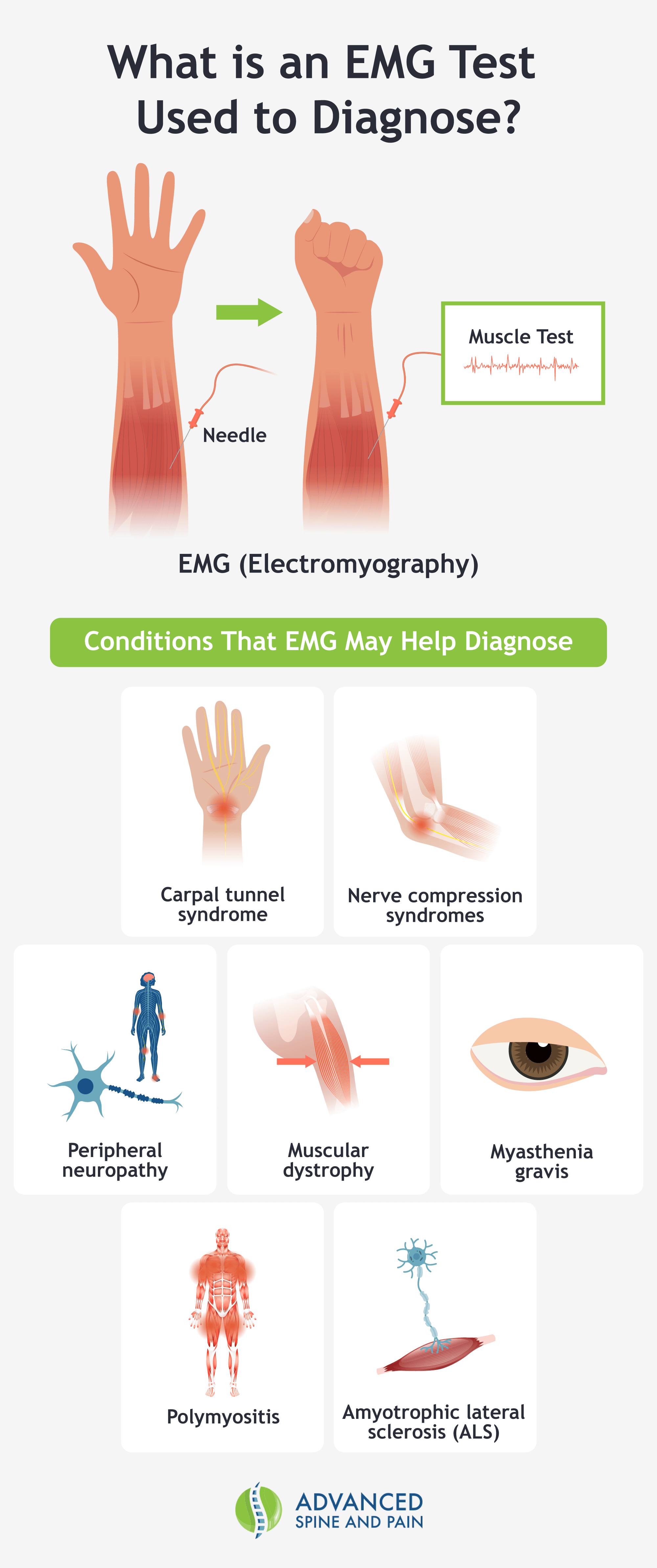 An infographic listing the different symptoms an EMG test can diagnose.
