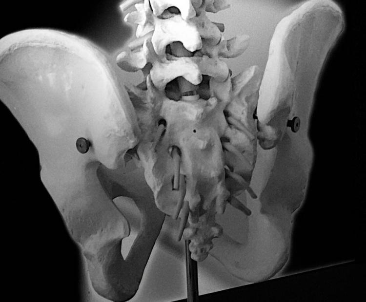 Skeleton model showing tailbone area