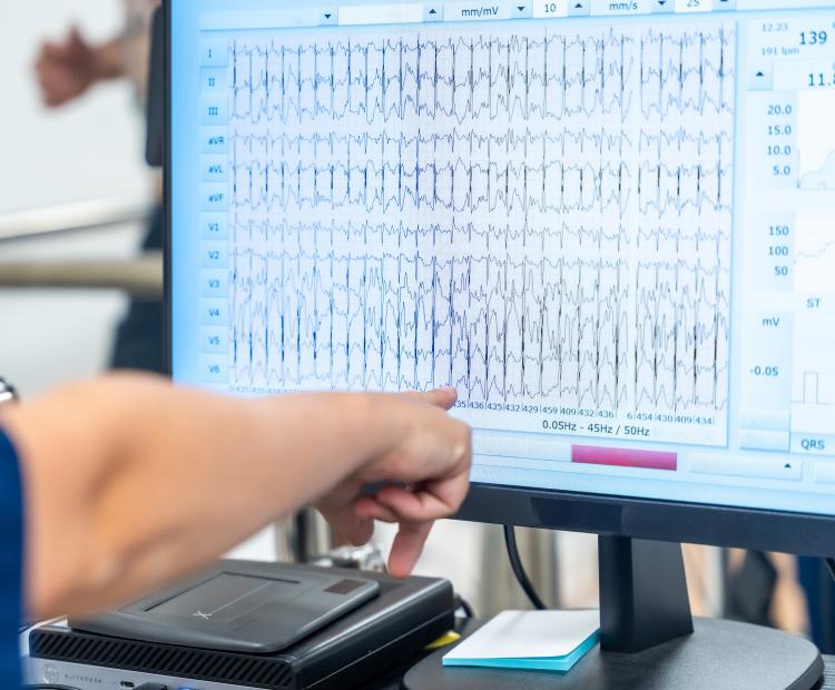 A healthcare professional reviewing EMG testing results.