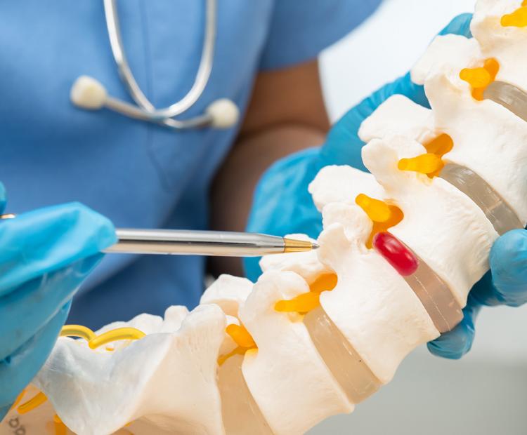 Understanding Herniated Disks: When Injections Are Not Enough