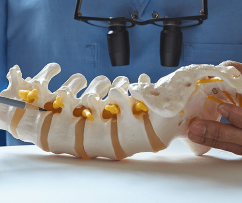 Doctor showing an area on a model of a spine