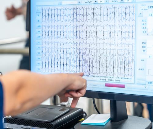 A healthcare professional reviewing EMG testing results.