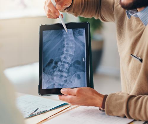 Doctors showing an x-ray of a curved spine to a patient on a tablet.
