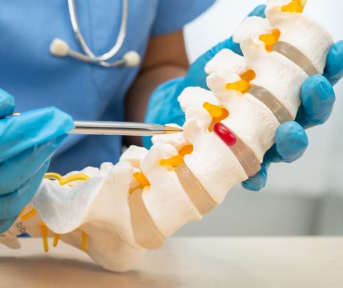 Doctor showing a model of a vertebrae