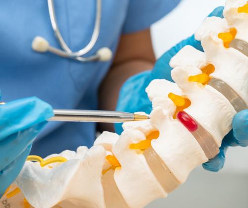 Understanding Herniated Disks: When Injections Are Not Enough