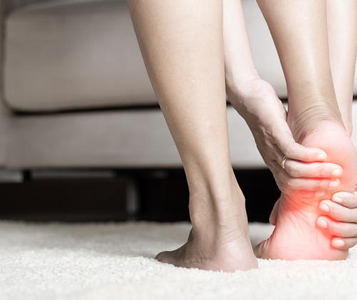 Plantar Fasciitis Embolization (PFE)