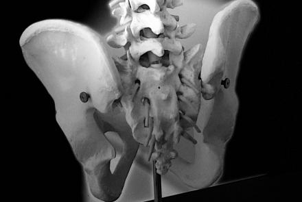 Skeleton model showing tailbone area