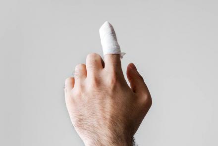 Man with an injured finger