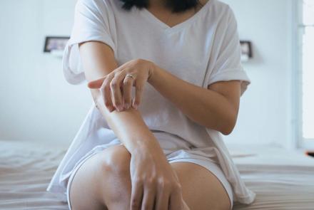 Woman scratching her arm