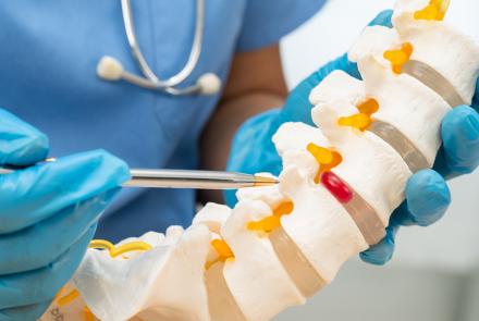 Understanding Herniated Disks: When Injections Are Not Enough